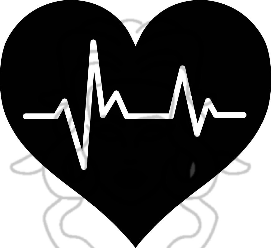 EKG