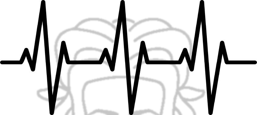EKG